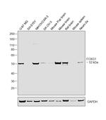 FOXG1 Antibody in Western Blot (WB)