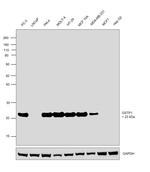 GSTP1 Antibody in Western Blot (WB)