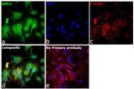 NME2 Antibody in Immunocytochemistry (ICC/IF)