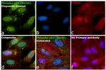 Phospho-p53 (Ser46) Antibody in Immunocytochemistry (ICC/IF)