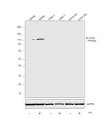 Klotho Antibody in Western Blot (WB)