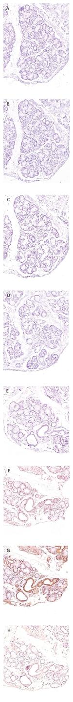 PADI2 Antibody in Immunohistochemistry (IHC)