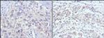 PAK2 Antibody in Immunohistochemistry (Paraffin) (IHC (P))