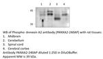 Phospho-Annexin A2 (Ser12, Thr18) Antibody in Western Blot (WB)