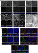 PAR3 Antibody in Immunocytochemistry (ICC/IF)