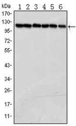 PARP1 Antibody in Western Blot (WB)