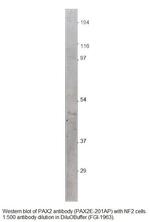 PAX2 isoform a + e Antibody in Western Blot (WB)