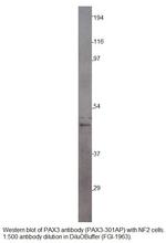 PAX3 Antibody in Western Blot (WB)