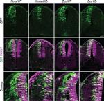 PAX3 Antibody in Immunohistochemistry (IHC)