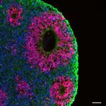 PAX6 Antibody in Immunohistochemistry (Frozen) (IHC (F))