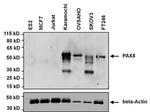 PAX8 Antibody in Western Blot (WB)