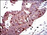 PBK Antibody in Immunohistochemistry (Paraffin) (IHC (P))