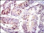 PBK Antibody in Immunohistochemistry (Paraffin) (IHC (P))