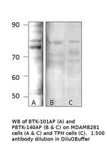 Phospho-BTK (Tyr551) Antibody in Western Blot (WB)