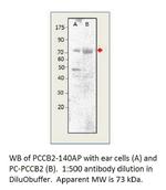 Phospho-CACNB2 (Ser621) Antibody in Western Blot (WB)