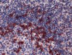 PD-1 Antibody in Immunohistochemistry (IHC)