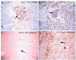 CD274 (PD-L1, B7-H1) Antibody in Immunohistochemistry (IHC)