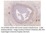 PDE8A Antibody in Immunohistochemistry (IHC)