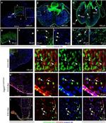 CD140b (PDGFRB) Antibody in Immunohistochemistry (IHC)