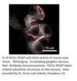 PGCG Antibody in Immunohistochemistry (IHC)