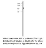 Progesterone Receptor Antibody in Western Blot (WB)