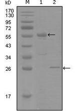 Progesterone Receptor Antibody in Western Blot (WB)