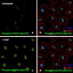 Human EGF Protein in Functional Assay (Functional)