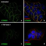 Human TGF-beta 1 Protein in Functional Assay (Functional)