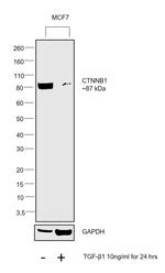 Human TGF-beta 1 Protein in Functional Assay (Functional)