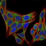 PI3K p85 alpha Antibody in Immunocytochemistry (ICC/IF)