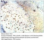 Pin1 Antibody in Immunohistochemistry (IHC)