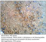 PKC epsilon Antibody in Immunohistochemistry (IHC)