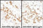 PKM2 Antibody in Immunohistochemistry (IHC)