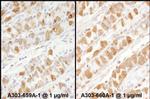 PKM2 Antibody in Immunohistochemistry (IHC)