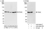 PKM2 Antibody in Western Blot (WB)