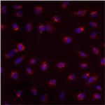 PMP70 Antibody in Immunocytochemistry (ICC/IF)