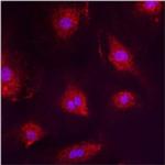 PMP70 Antibody in Immunocytochemistry (ICC/IF)