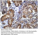 PMS2 Antibody in Immunohistochemistry (IHC)