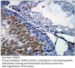 POMT1 Antibody in Immunohistochemistry (IHC)