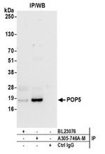 POP5 Antibody in Immunoprecipitation (IP)