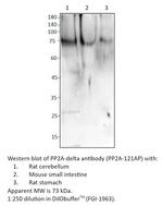 PP2A-delta Antibody in Western Blot (WB)