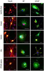 PPAR alpha Antibody in Immunocytochemistry (ICC/IF)