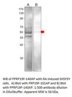 Phospho-PRP19 (Ser372) Antibody in Western Blot (WB)