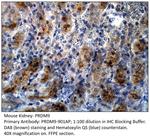 PRDM9 Antibody in Immunohistochemistry (IHC)