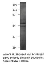 PRP19 Antibody in Western Blot (WB)