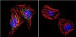 PSD-95 Antibody in Immunocytochemistry (ICC/IF)