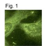 Presenilin 1 Antibody in Immunocytochemistry (ICC/IF)