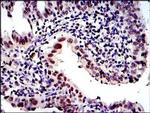 PSMB8 Antibody in Immunohistochemistry (Paraffin) (IHC (P))