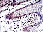 PSMB8 Antibody in Immunohistochemistry (Paraffin) (IHC (P))