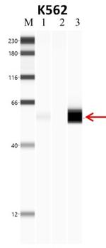 PTBP1 Antibody in Immunoprecipitation (IP)